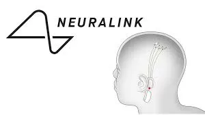 Neuralink