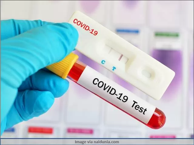 RT-PcR COVID Test