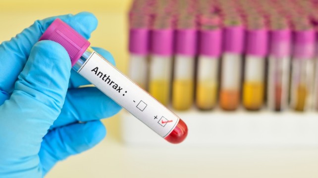 Anthrax Pneumonia Case In China, Patient Under Treatment: Report