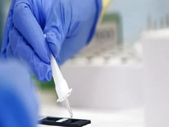 COVID-19 testing kit, Source: AP