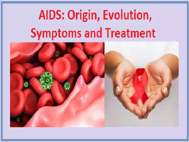 History of AIDS