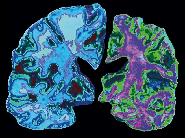 JNCASR Scientists develop new molecule for Alzheimer’s treatment