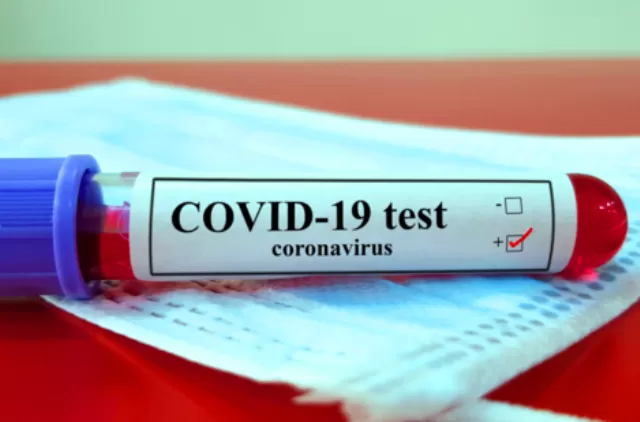 International Finance Corporation invests $16.5 million in MedGenome to speed up COVID-19 testing in India