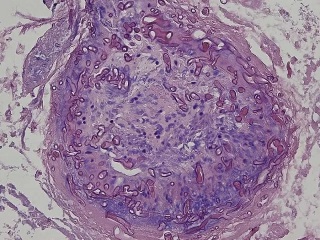 Reference Image