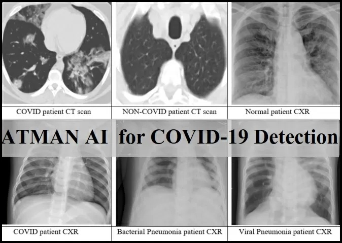 ATMAN AI by DRDO for COVID-19 detection in chest X-rays 