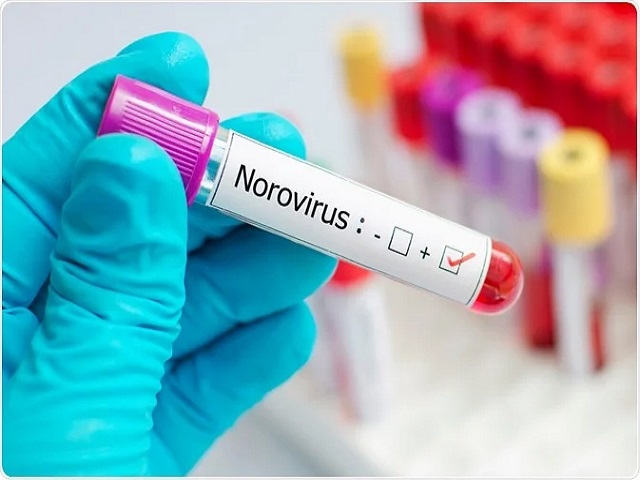 What is Norovirus? Check Symptoms, Preventive Measures, Treatment, and Incubation Period of the virus