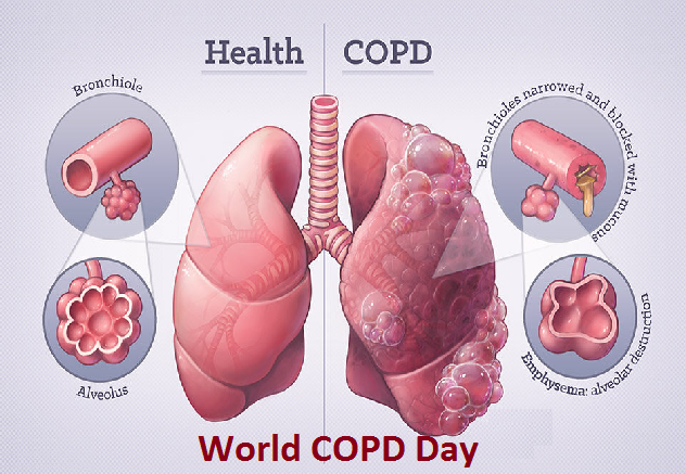 World COPD Day 2021: Current Theme, History, Significance, and Key Facts