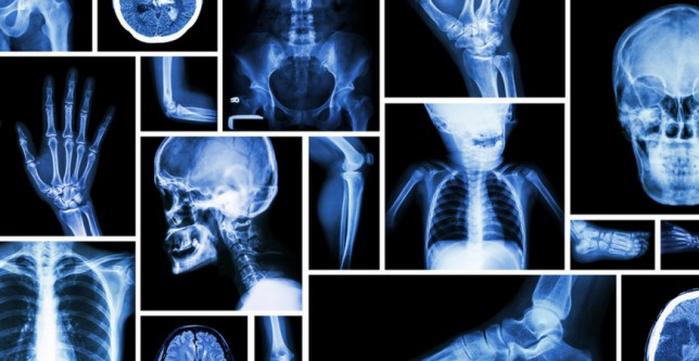 World Radiography Day 2021: All you need to know