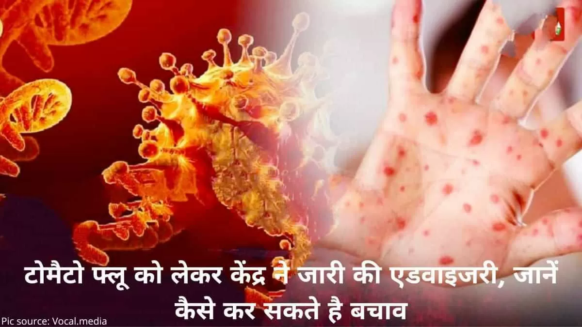 Tomato Flu disease