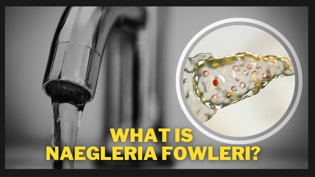 What Is Naegleria Fowleri The Deadly Brain Eating Amoeba Infection 