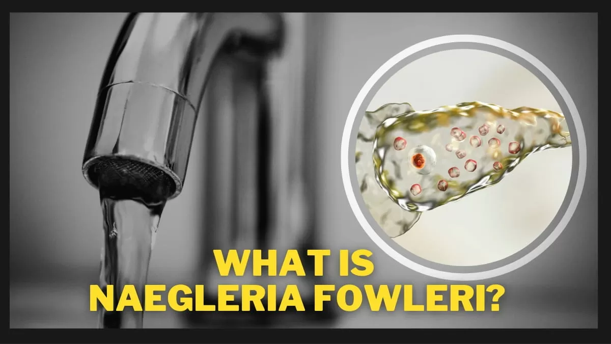 What Is Naegleria Fowleri The Deadly Brain Eating Amoeba Infection 