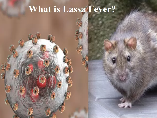 Lassa Fever Explained Symptoms Treatment And Recent US Case 2024   Lassa Fever.webp