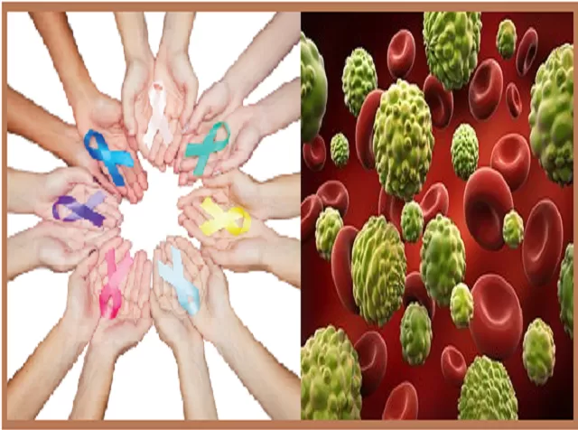 Types of Cancer