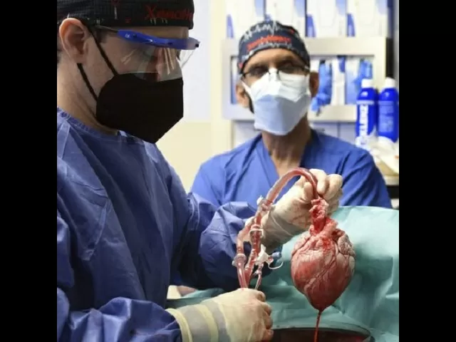 US Doctors transplant pig heart into a human