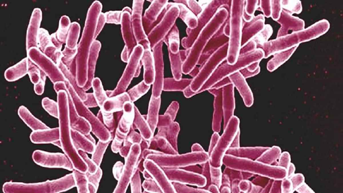 Opposite Zoonosis in Tuberculosis imaginable?