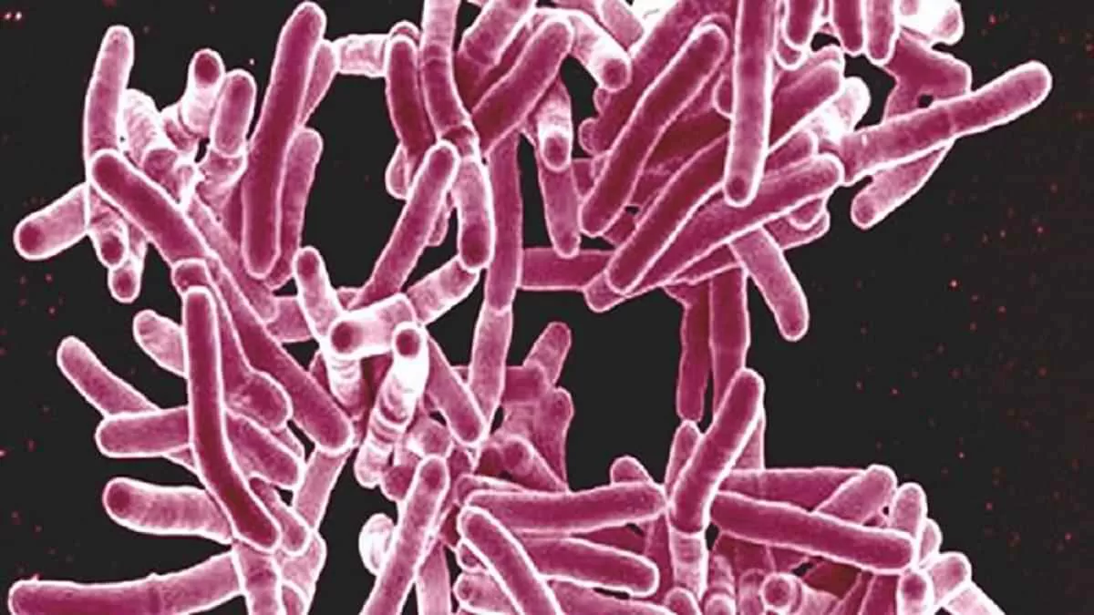 Reverse Zoonosis in Tuberculosis possible?