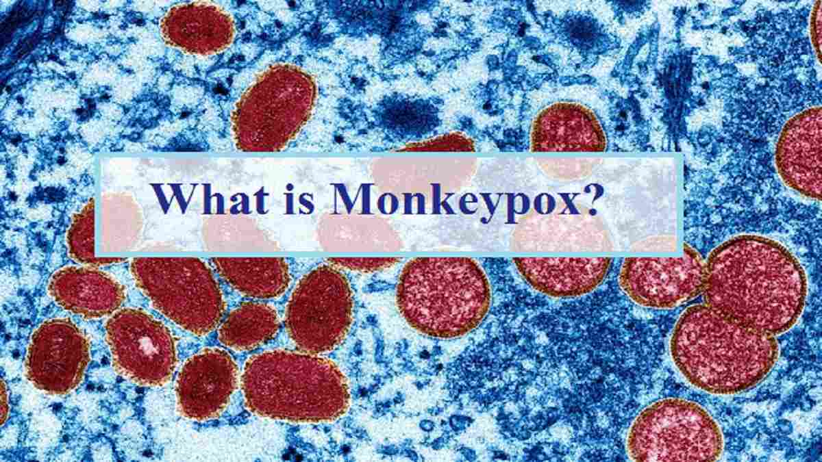 What Is Monkeypox? Check Symptoms, Transmission, Prevention, Treatment ...