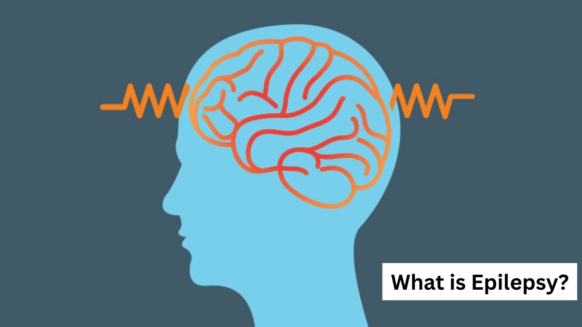 What is Epilepsy? Symptoms, Causes, Diagnosis, Treatments, Precautions, & More