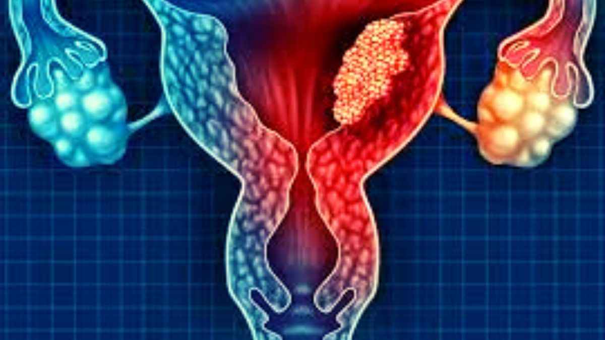 Why Are Experts Urging To Include Cervical Cancer Vaccine In Universal Immunization Program? Know All Reasons Here
