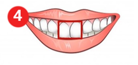Teeth Shape Personality Test: What does your teeth say about your personality?