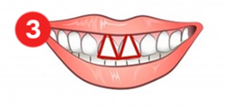 Teeth Shape Personality Test: What does your teeth say about your personality?