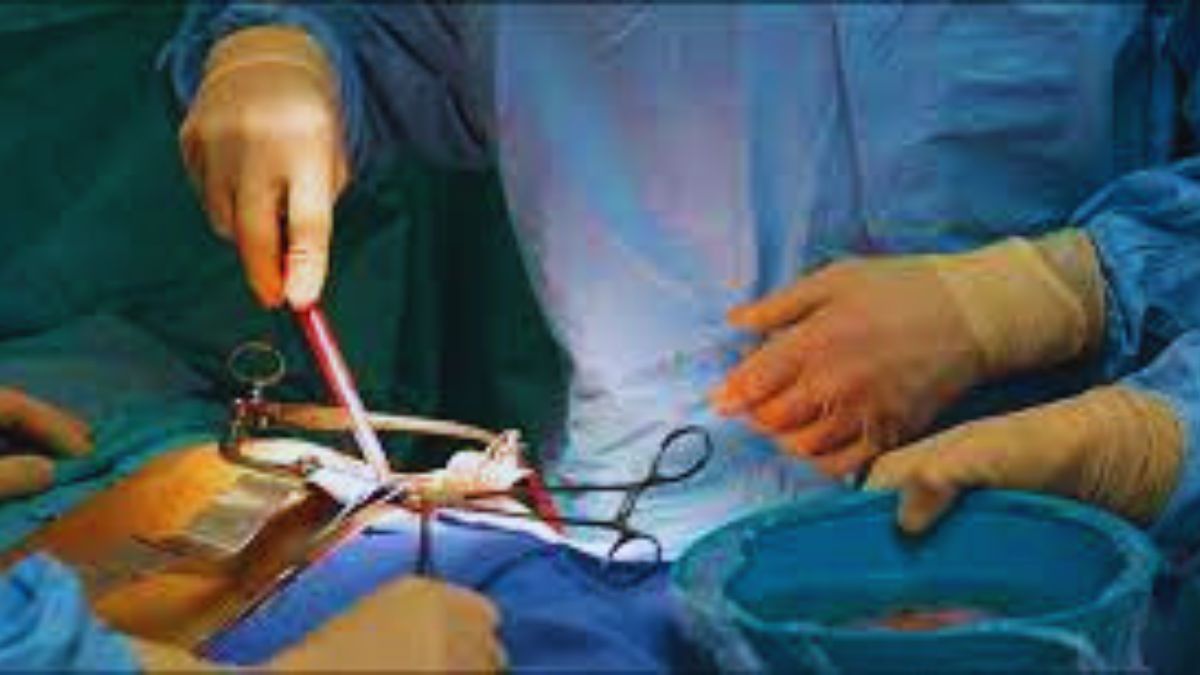 What is the cash for kidney racket? Here is the complete kidney scam unveiled