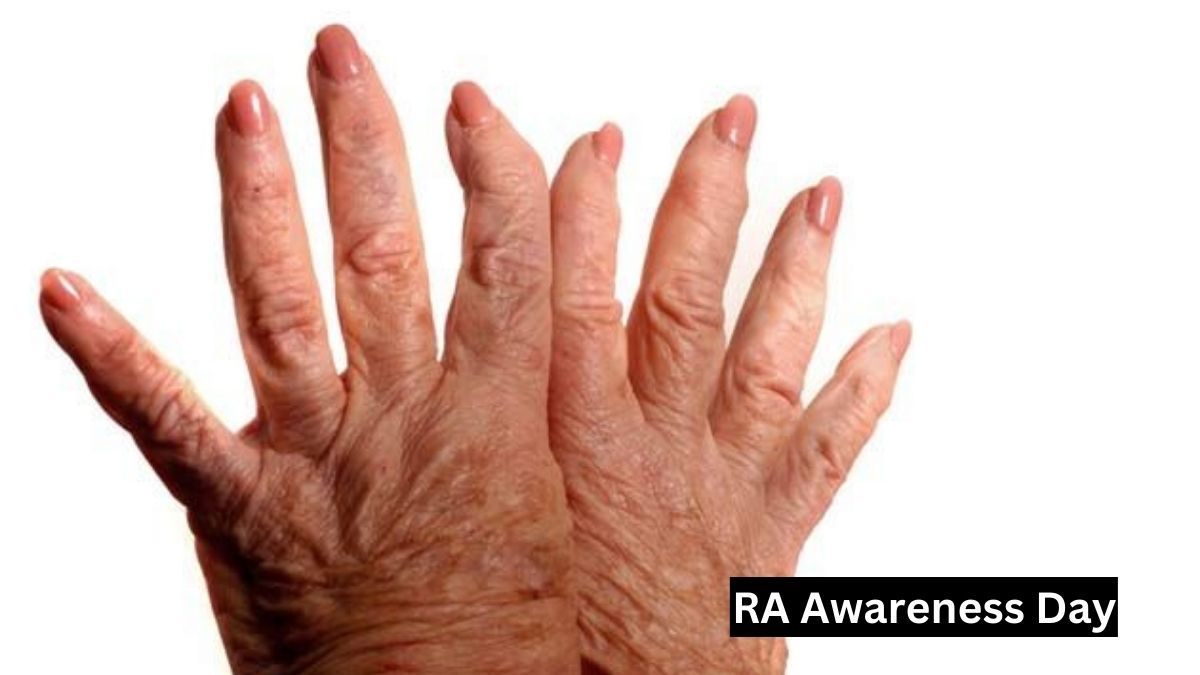 Rheumatoid Arthritis Awareness Day 2023 Date, Theme, History