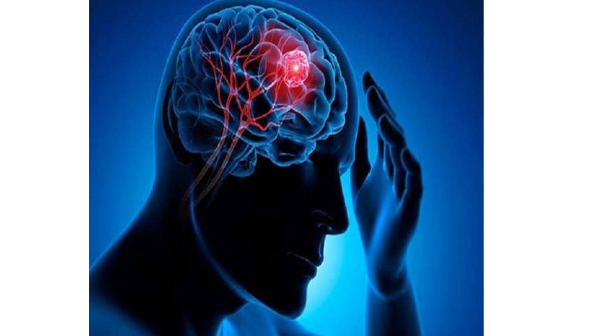 What Is Brain Fog Causes Symptoms Precaution Treatment And More 