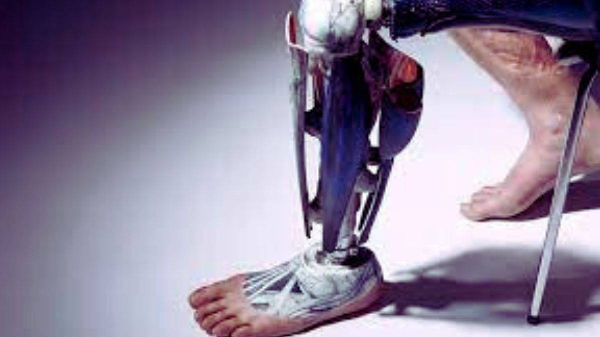 A new type of prosthetics can give you nerve-mimicking experience. What is it?
