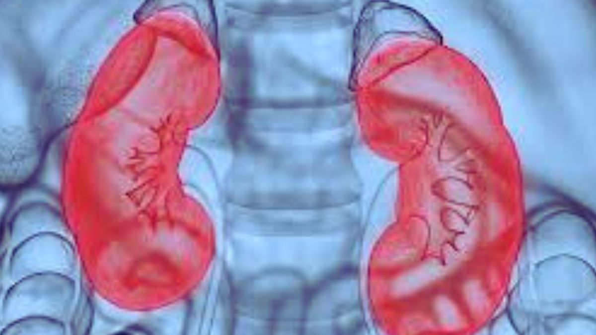What is the nephrotic syndrome? Know its symptoms