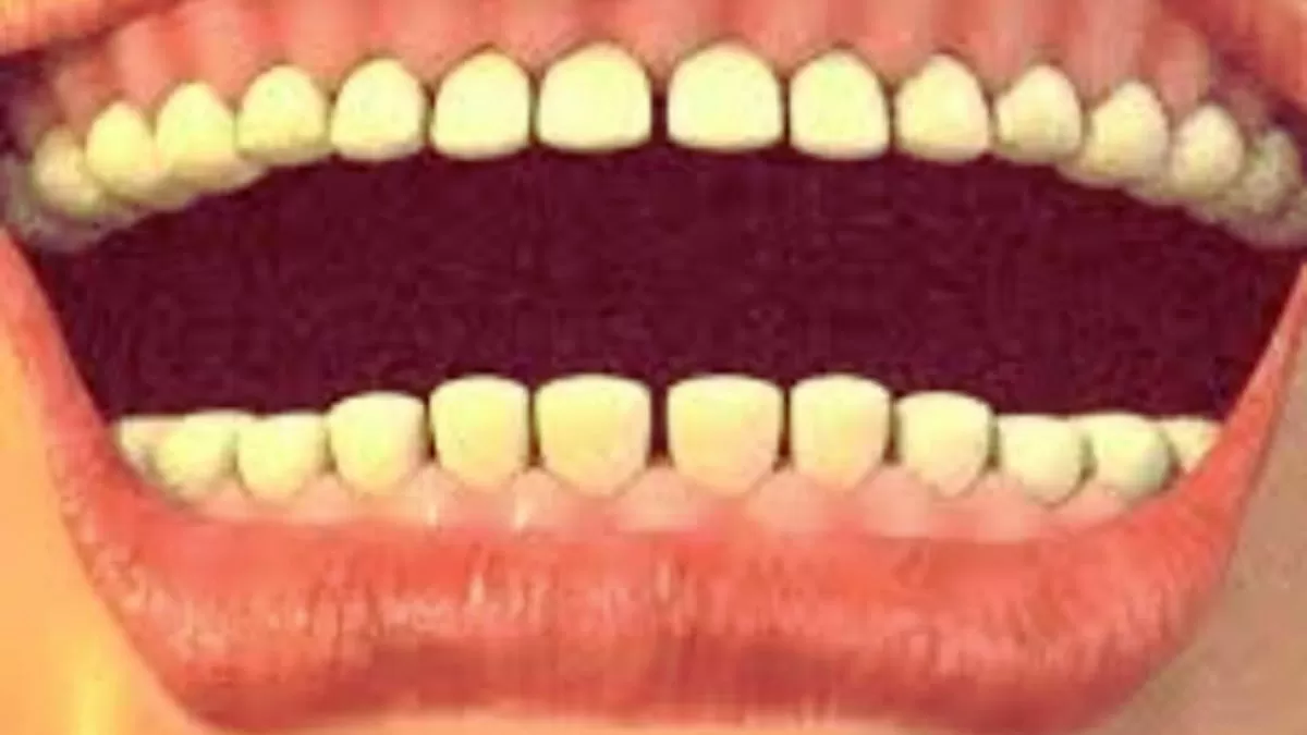 Find the hidden germ in the teeth.