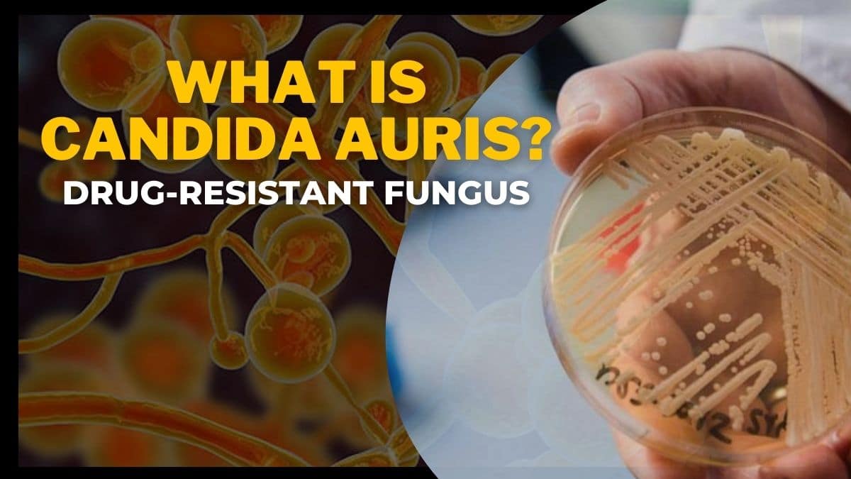 What Is Candida auris? A Drug-Resistant Fungus. All You Need To Know