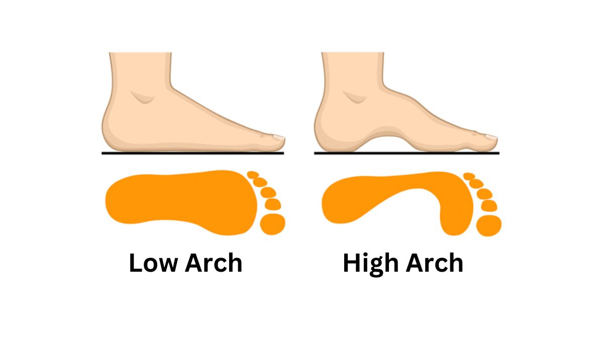 Personality Test Your Feet Arch Reveals Your Hidden Personality