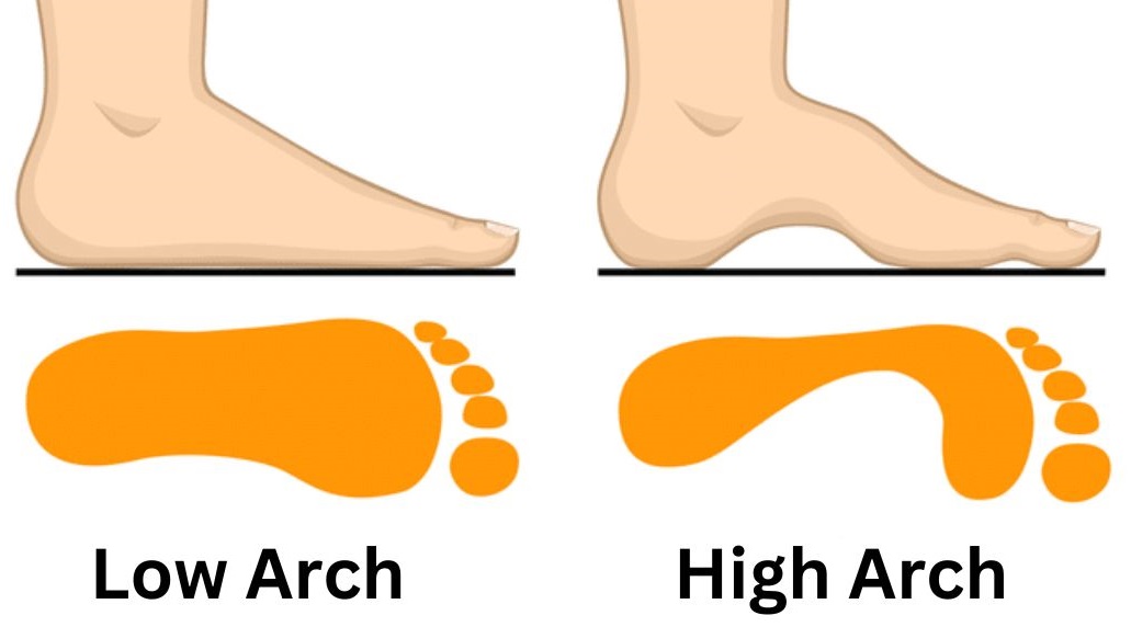 Arch Height: How To Tell If You Have High Arches Or Flat Feet