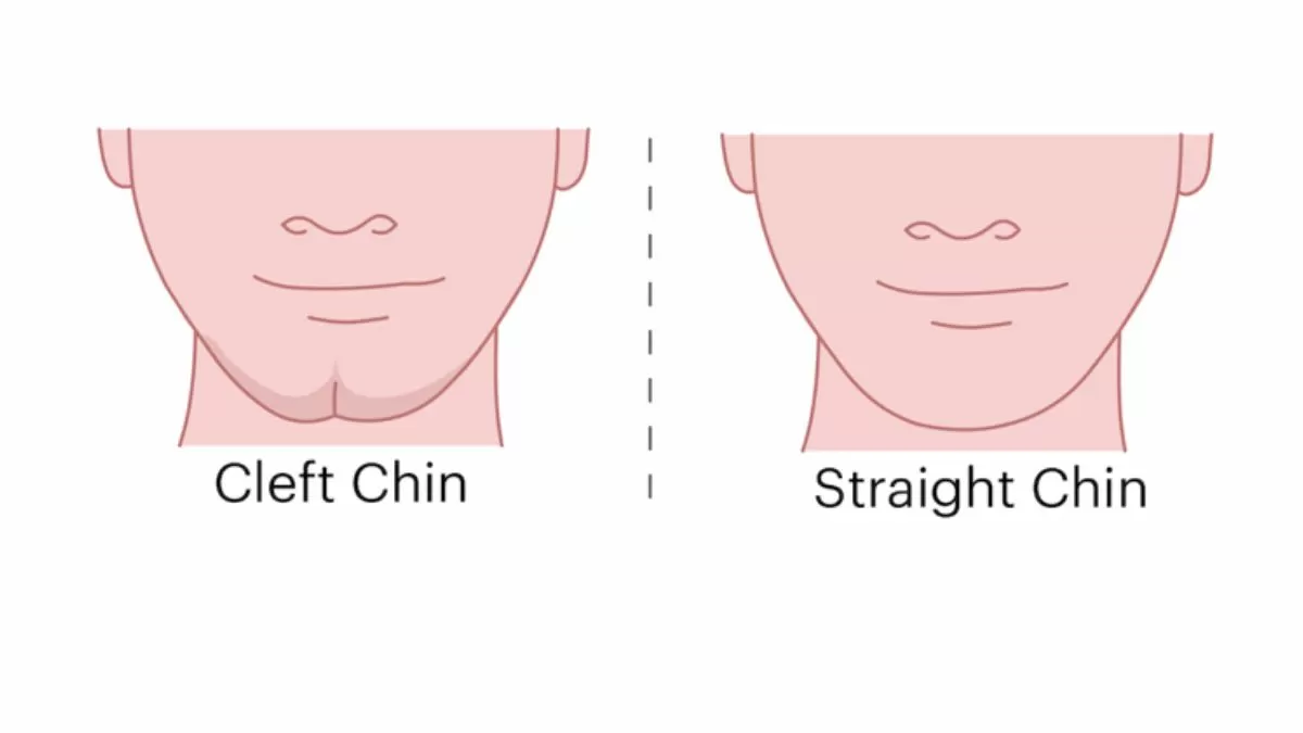 Dimple Chin Personality Test