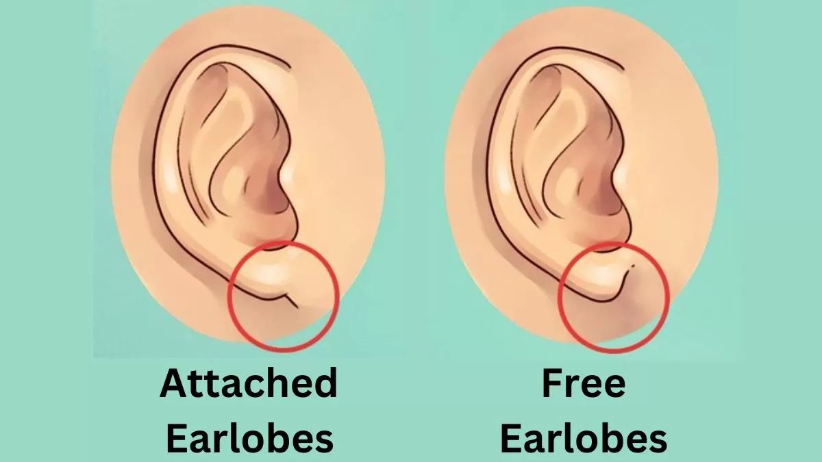 Hanging Off My Earlobes Is A Rock What Are Hanging Earlobes at Jamie Fitzsimmons blog