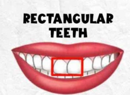 Rectangular Teeth Shape Personality Traits
