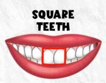Square Teeth Shape Personality Traits