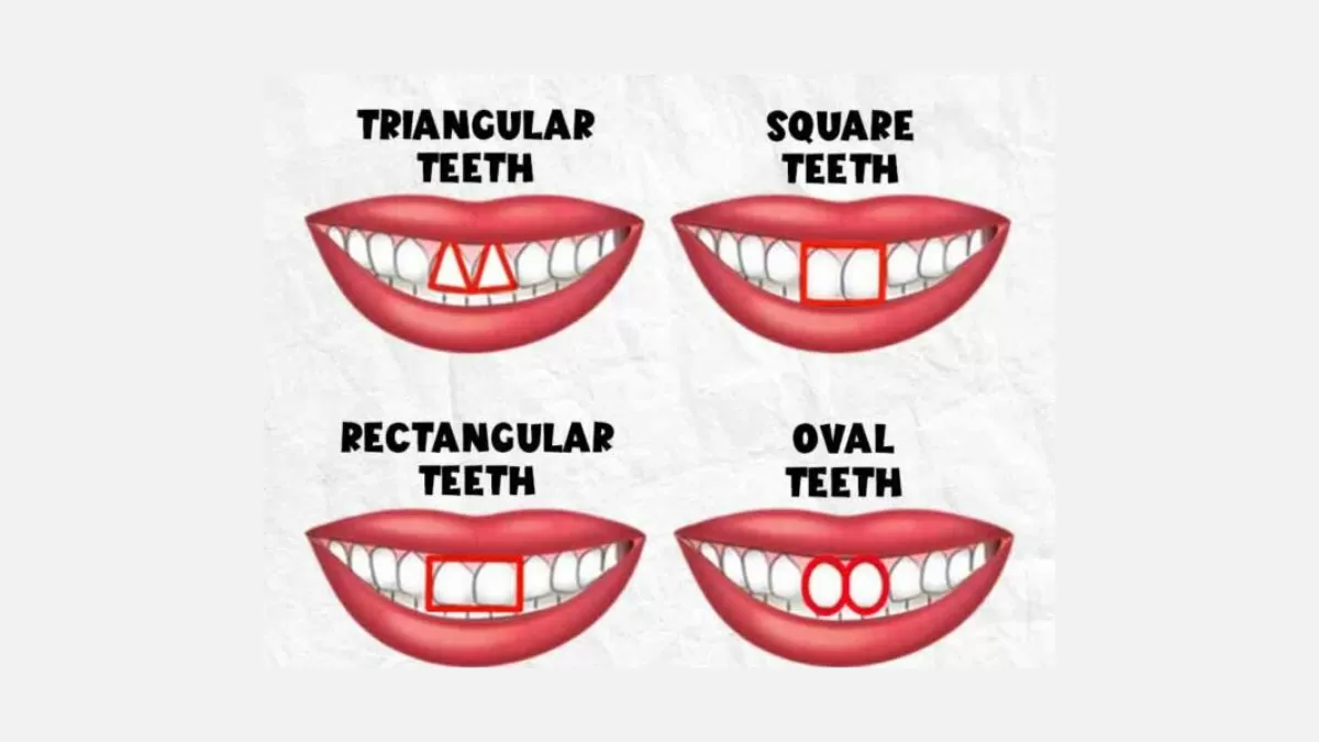 Personality Test: Your Teeth Shape Reveals Your Hidden Personality Traits