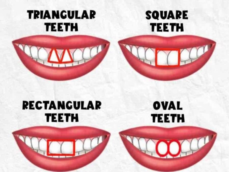 Personality Test: Your Teeth Shape Reveals Your Hidden Personality Traits