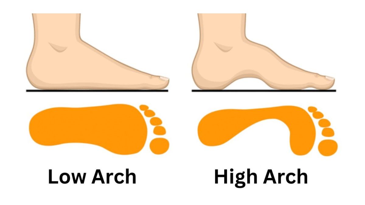 Personality Test: Your Feet Arch Reveals Your Hidden Personality Traits