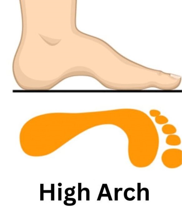 High Arch Feet Personality Traits