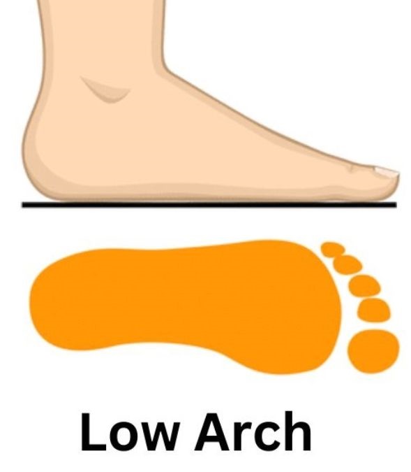 Low Arch Feet Personality Traits