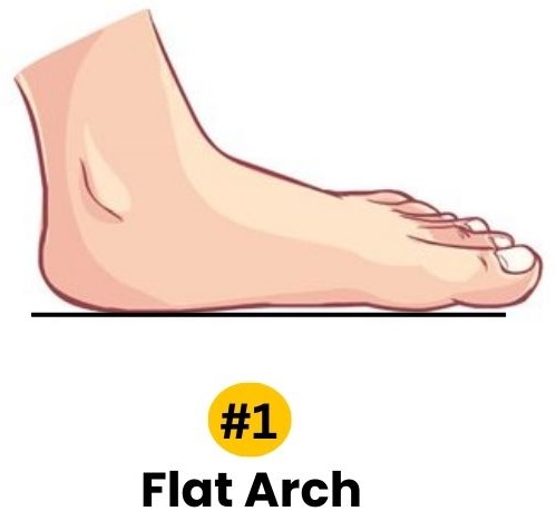 foot arch personality traits