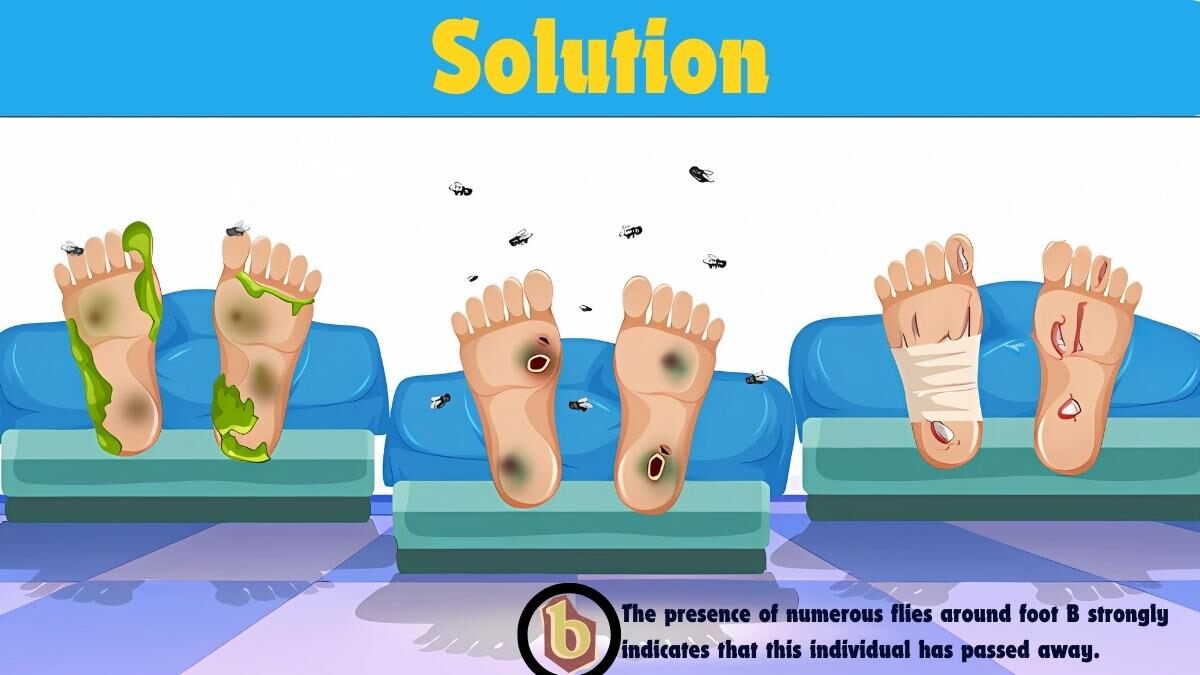 Picture Puzzle IQ Test: Find the Dead Person in 5 Seconds | 150+ IQ Score