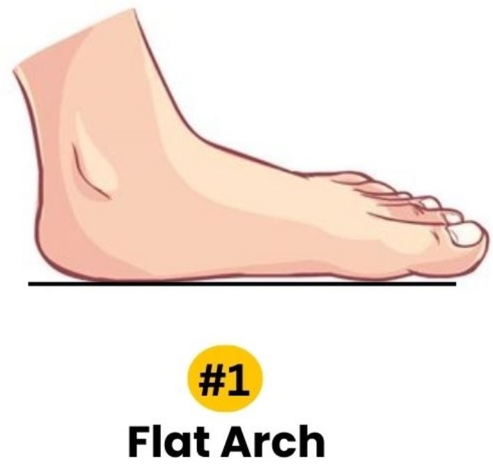 Flat Arch Foot Personality Traits
