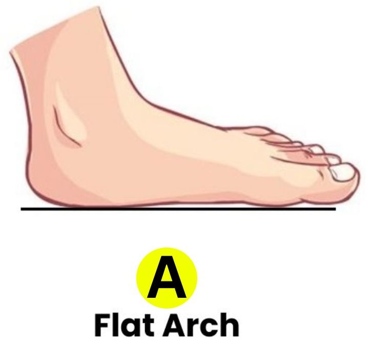 flat feet personality traits