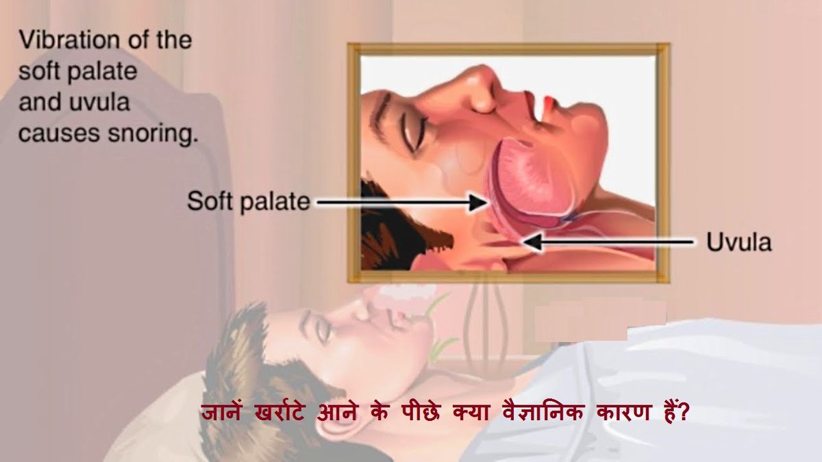 Why do People Snore: Scientific Reasons?
