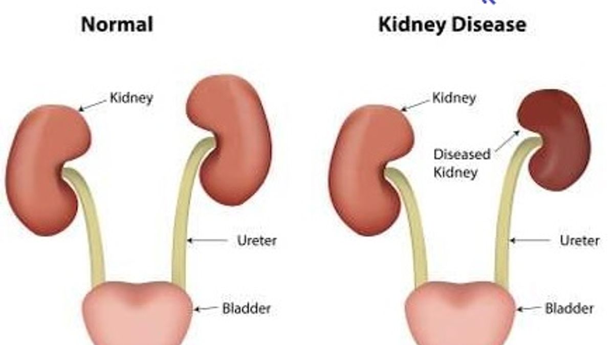 Various types of kidney diseases