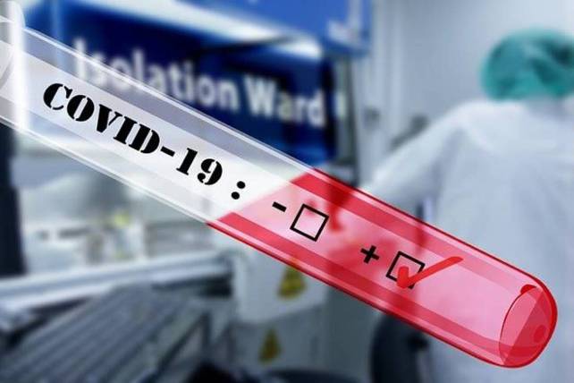 DCGI ने कम लागत के कोविड -19 परीक्षण 'फेलुदा' के वाणिज्यिक शुभारंभ को दी मंजूरी 